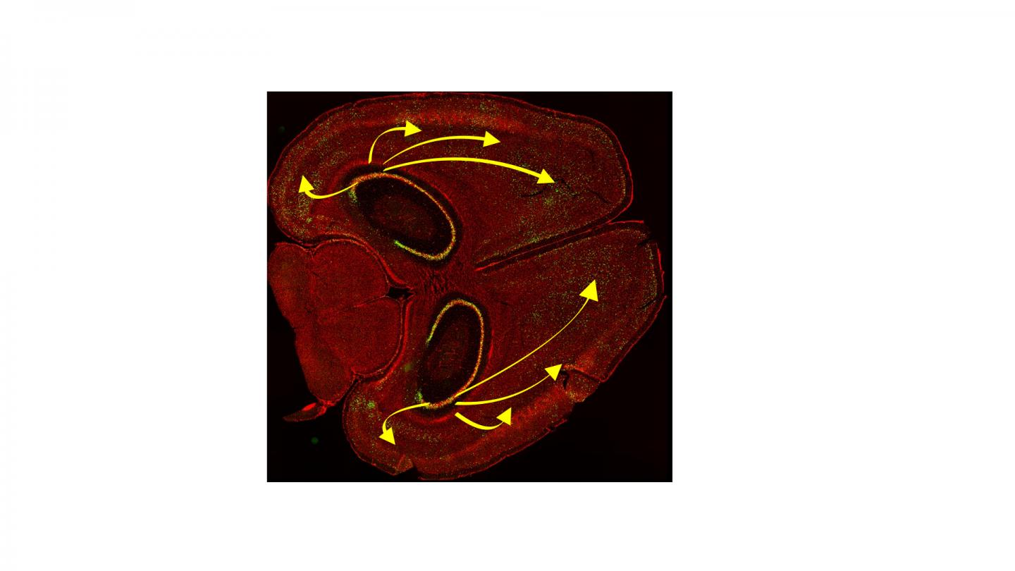Visualizing How the Brain Retrieves Memories