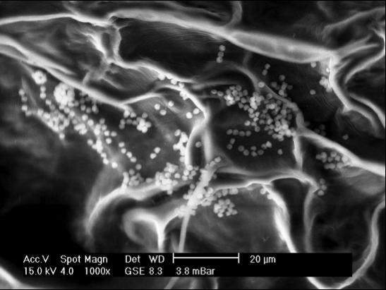 Infection at 1000x Magnification