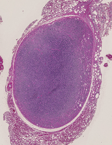 UTSW study: RNA exosome key for B cell development