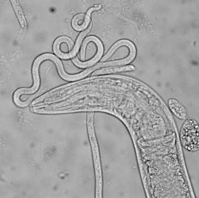 Unraveling the Elephantiasis Worm Genome (2 o  EurekAlert!