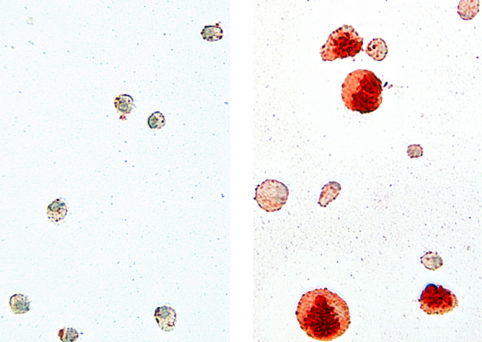 Alveolar macrophages