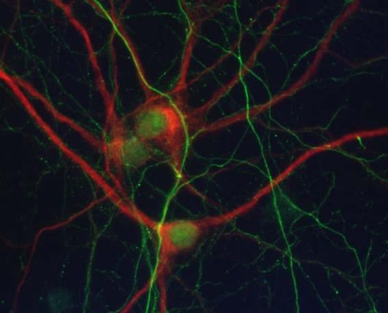 Neuronal Cell Culture