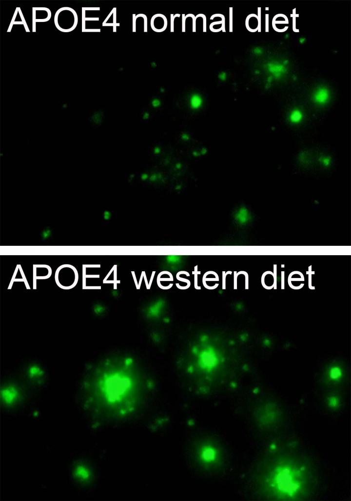 Obesity Accelerates Alzheimer-related Pathology in APOE4 but Not APOE3 Mice