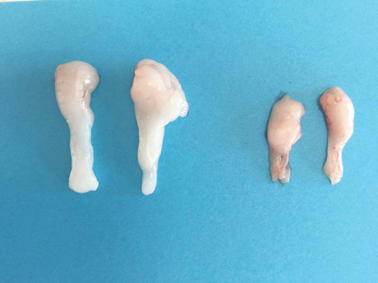 What Links Light, Fat and Microbes in the Gut?