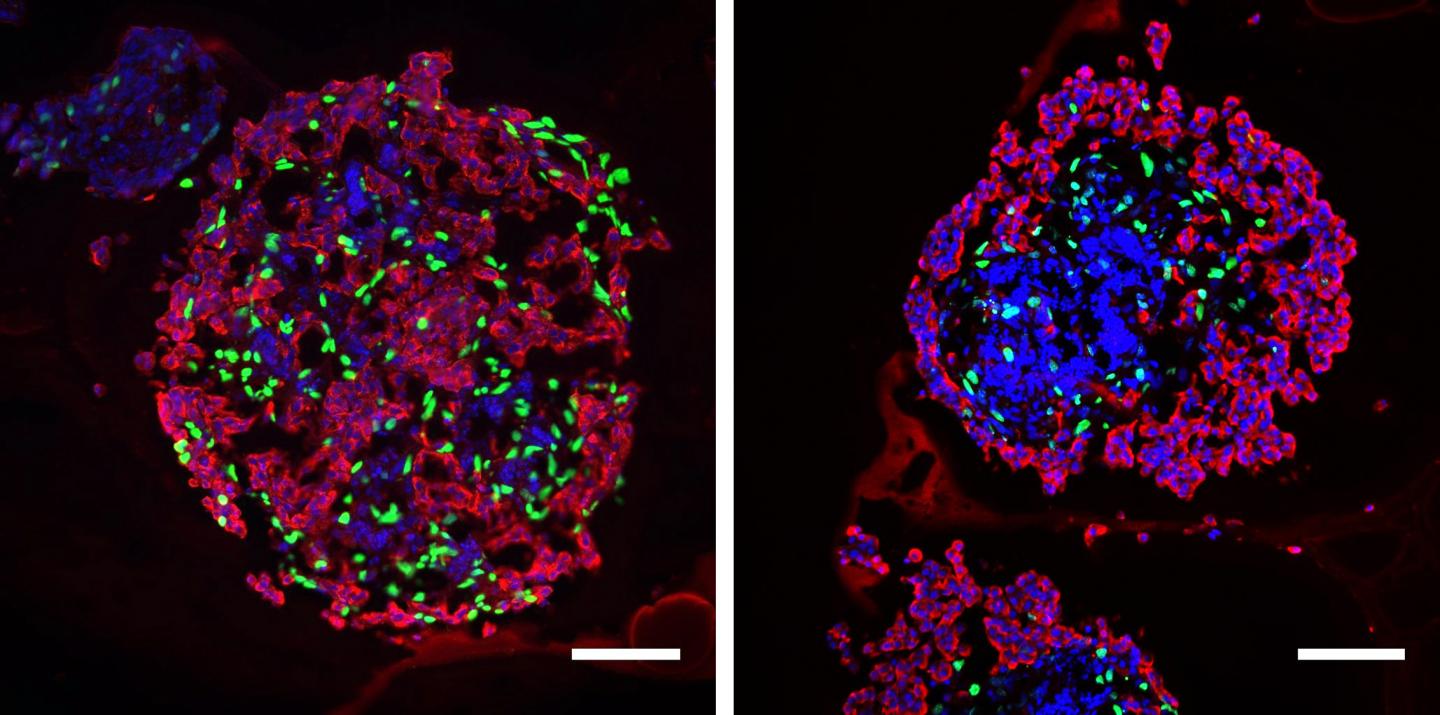 Pancreatic Cells without (Left) and with (Right) Thyroid Hormone