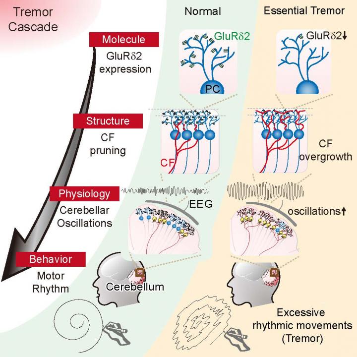 EEG Studies in Patients, Mice Reveal the Roots of Essential Tremor (2 of 3)