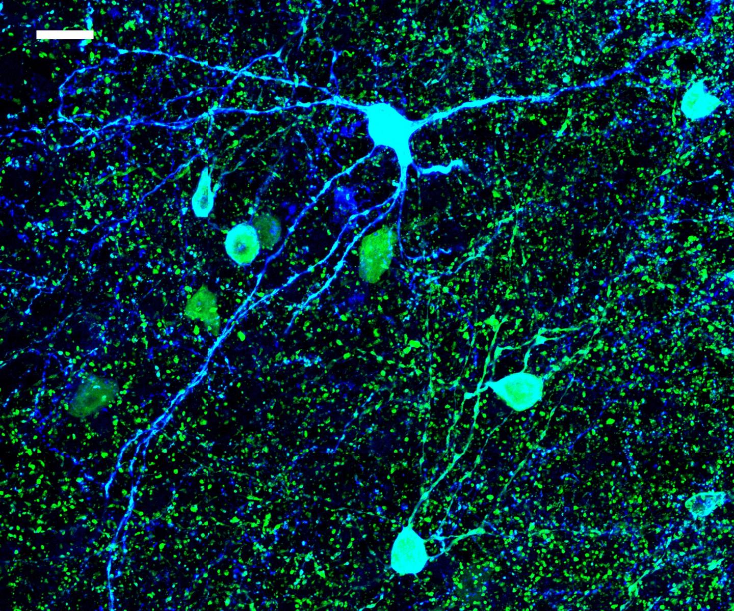 Fine Tuning Memory In The Brai [image] Eurekalert Science News Releases