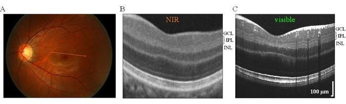 Near-infrared OCT compared with visible-light OCT