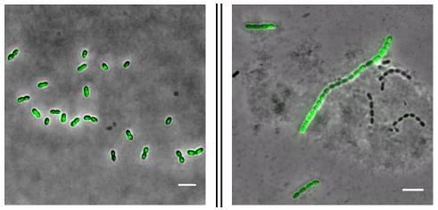 <em>Streptococcus pneumoniae</em> Growing with and without Antimicrobials