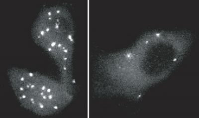 Cells Less Invasive Without FAK