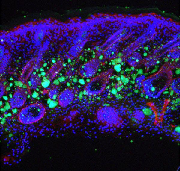 Skin Cells, Richard Gallo, UC San Diego School of Medicine