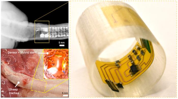 Robotic sensory cilia that monitor internal biomarkers to detect and assess airway diseases