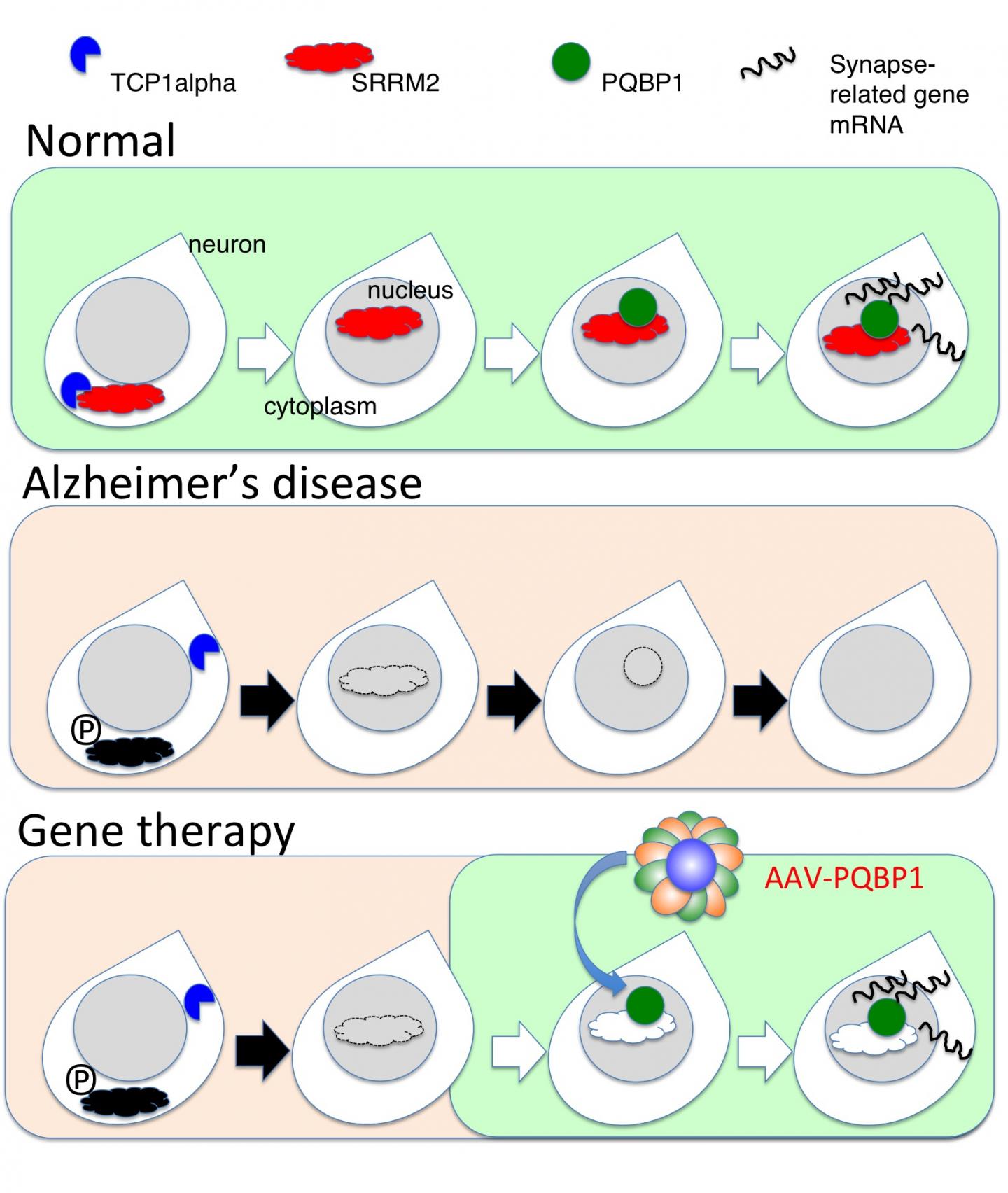 Theory of Gene Therapy by AAV-PQBP1