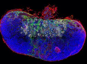 Sentinel lymph node structure