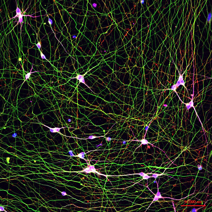 human stem cell-derived neurons in a dish