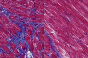 Scar formation in heart reduced in mice treated with monoclonal antibody