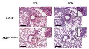 Mice engineered with a patient gene (JAK1 GOF: Neuron) show less lung inflammation, fewer immune cells, and reduced mucous production compared to controls