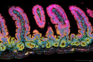 T cells in the small intestines