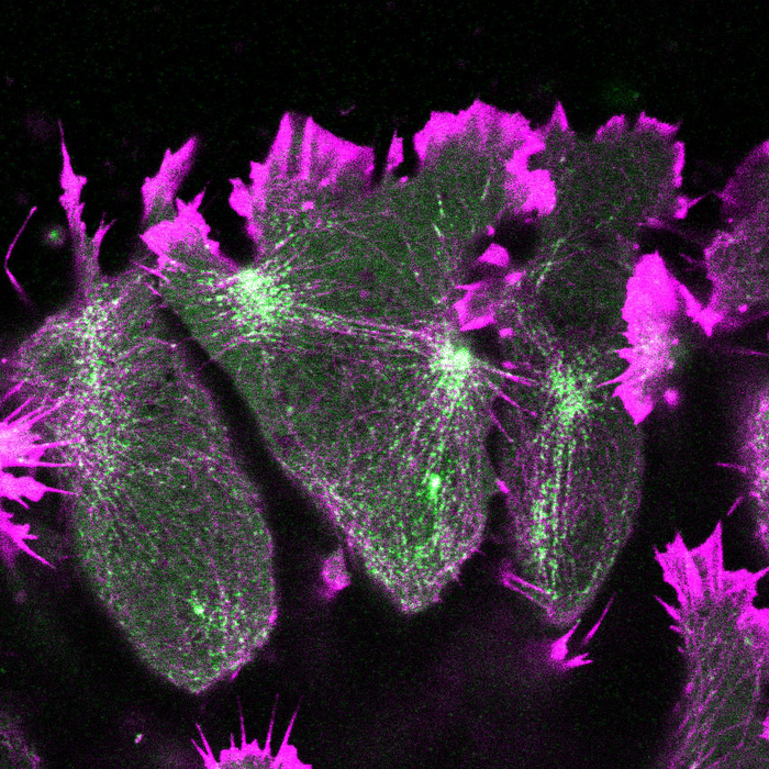 Actomyosin