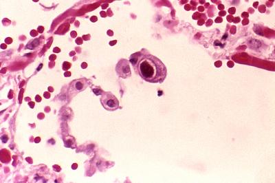 Cells Infected with Cytomegalovirus