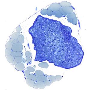 Microscopic cross-section through a peripheral nerve bundle.