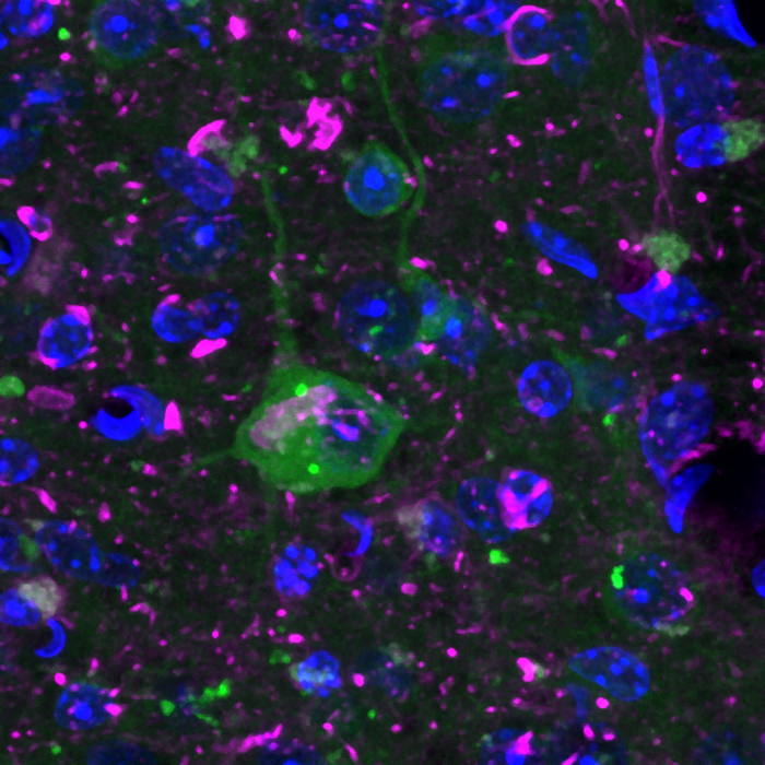 Cells mimicking Alzheimer's disease