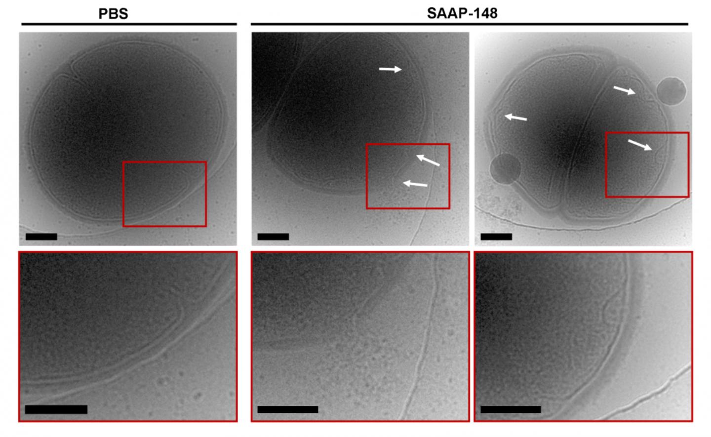 Biofilm Buster Treats DrugResistant Infectio EurekAlert!
