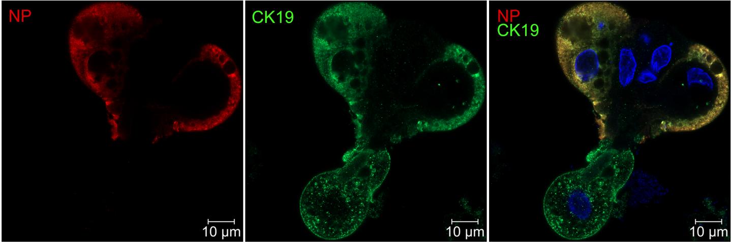 MERS Virus May Also Infect Humans Through Intestinal Tract (2 of 3)