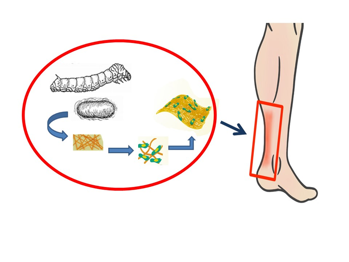 Repairing Tendons with Silk Proteins