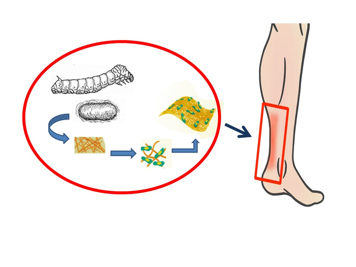 Repairing Tendons with Silk proteins