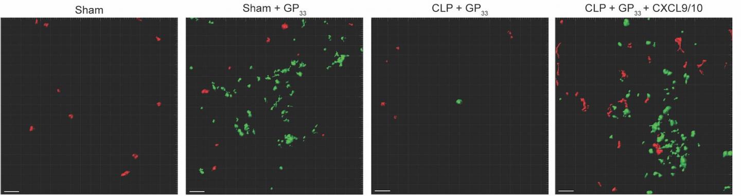 Scientists Find Potential Mechanism for Deadly, Sepsis-Induced Secondary Infection