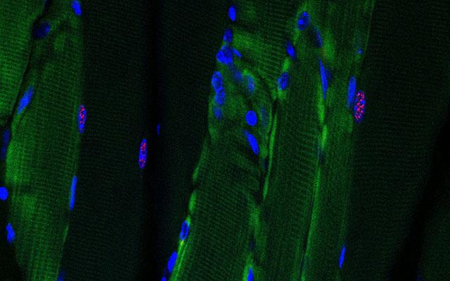 Longitudinal Muscle Fibers