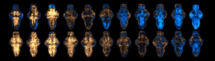 Examples of T-Score Brain Activity Maps