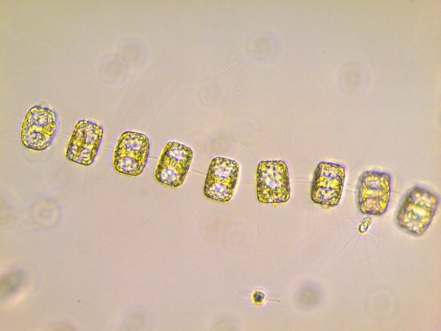 Diatoms Are Unique Phytoplankton