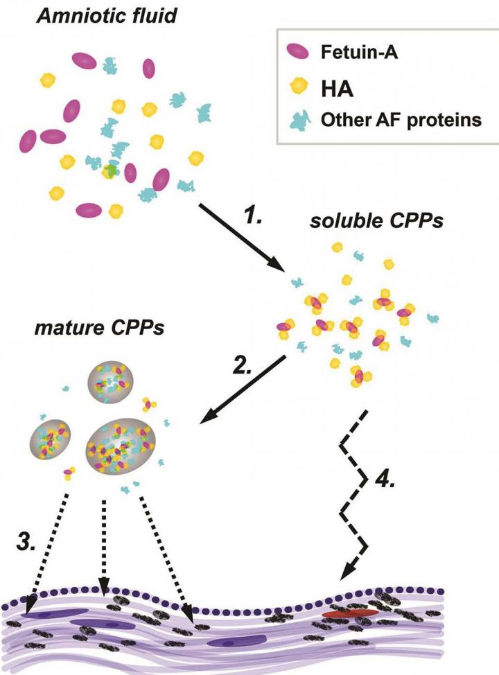 Particle Clusters Named a Culprit in Premature Birth (2 of 2)