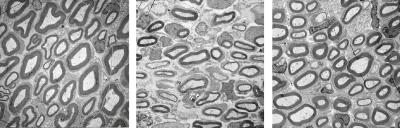 Electron Microscopic Image of Nerves