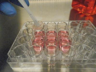 A Synthetic Scaffold Structure Similar to the Bone Is Placed into a Vessel