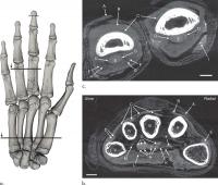 Images Show CT of Mummified Hand.