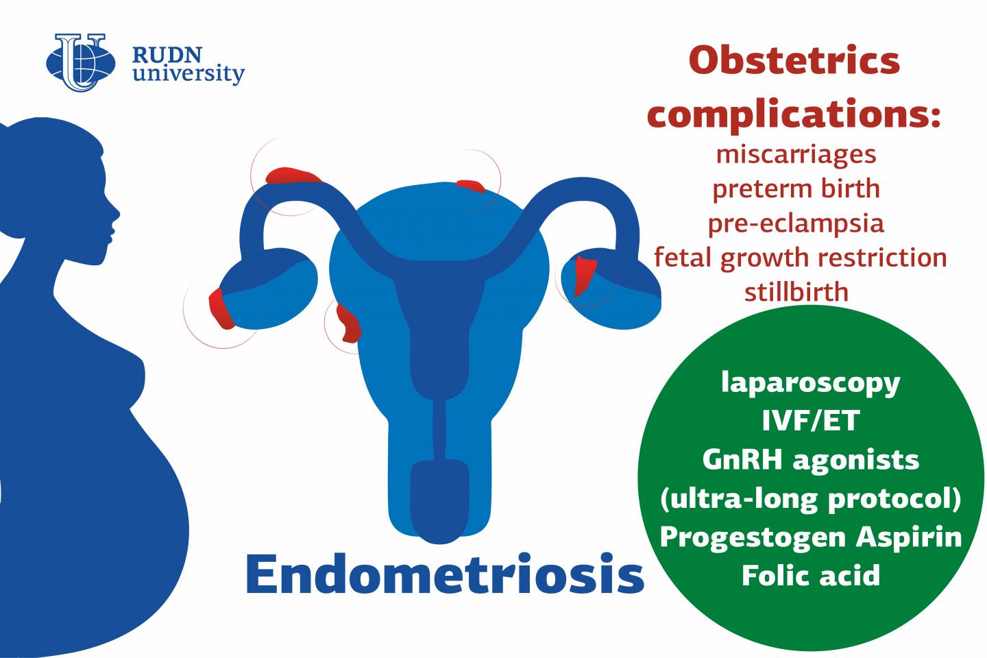 Doctors from RUDN University Suggested Ways to Reduce Obstetrical Complications in Patients with Endometriosis