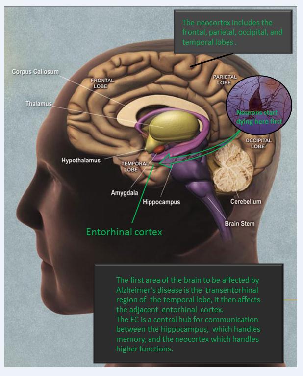 Affects of Alzheimer's on the Human Brain