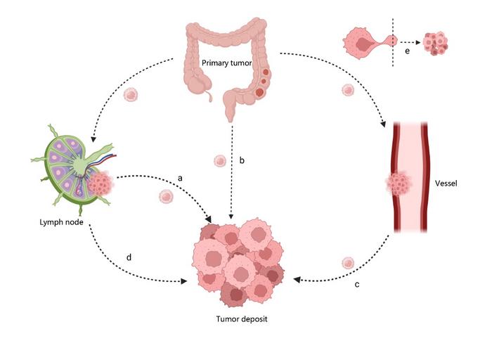 Several possible sources of TDs