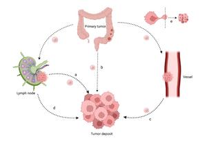 Several possible sources of TDs