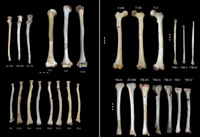 Upper and Lower Limb Bones of Those Adults Found in Sima De Los Huesos, Atapuerca, Spain