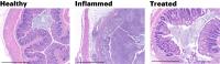 Histology Demonstrates PATCH Action in the Mouse Mucosa