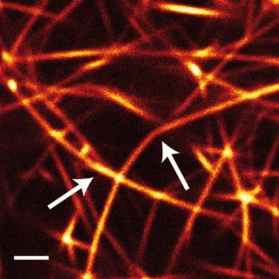 Microstructure of an Actin/Fascin Bundle Network