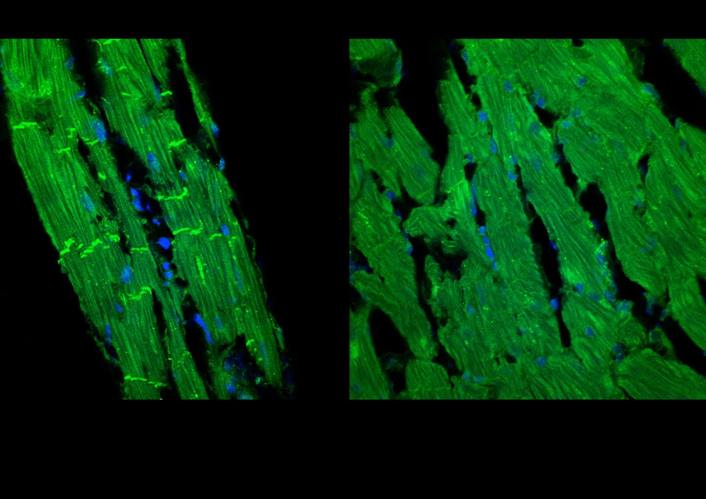 Relaxin Treated Ventricular Tissue