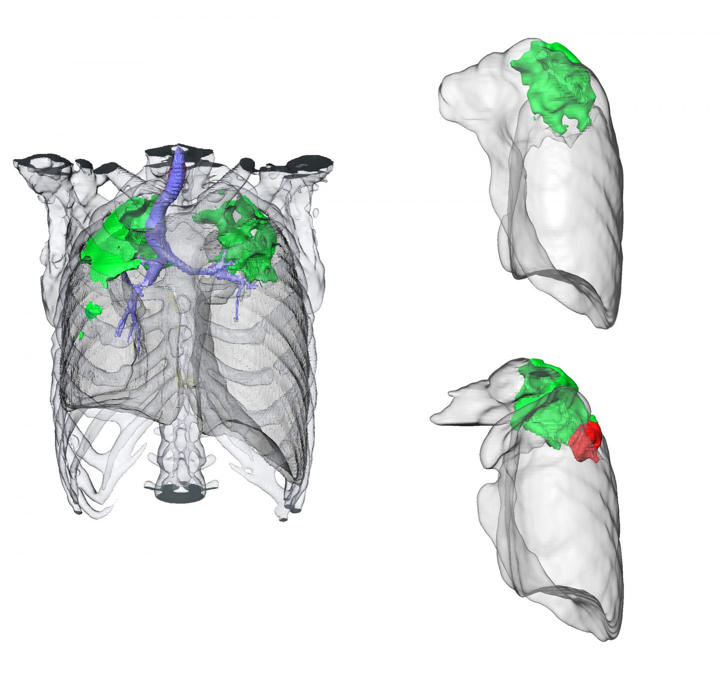 Imaging Technology May Speed Up Identification of New Tuberculosis Drugs (2 of 2)