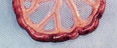 Untreated Small Intestine