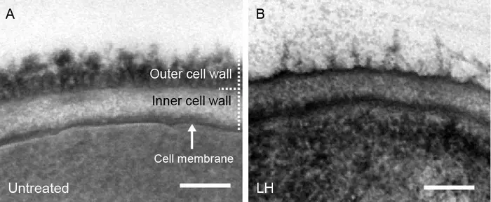 Electron microscopy micrograph of C. albicans, before and after treatment with synthetic polymers