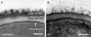 Electron microscopy micrograph of C. albicans, before and after treatment with synthetic polymers